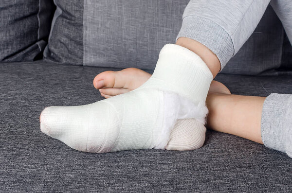 Close up of a leg young girl fiberglass. Child with Plaster bandage on leg cast and toes after injury fracture, dislocation, sprain. Human healthcare and medicine concept 
