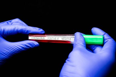Mavi eldivenli eller daper test tüpü ve koronavirüs siyah arkaplanla sonuçlanır