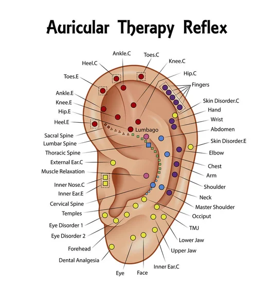 Auriculáris terápia Reflex diagram — Stock Vector