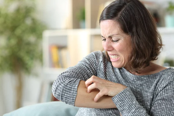 Mujer Mediana Edad Rascarse Piel Picante Sentado Sofá Casa — Foto de Stock