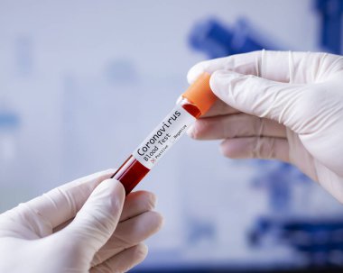 Covid 19 Coronavirus numunesi enfeksiyon kapmış kan numunesi tıbbi bir bilim adamının elinde. Koruyucu giysiler giyiyordu.