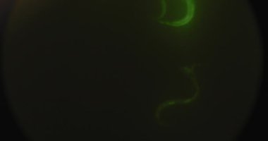 Mikroskop altında vurgulanmış yeşil mikroorganizmalar, c-elegans (Caôhabditis elegans) nematode kurtçukları, bir petri kabında hareket ediyorlar, makro çekim. Bmpcc 4k. Biyokimya, ilaç, bilim.  