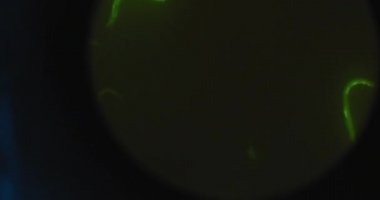 Vurgulanmış yeşil mikroorganizmalar, mikroskop altında C-elegans nematode solucanları, bir petri kabında hareket ediyorlar, makro çekim. Bmpcc 4k. Biyokimya, ilaç, bilim.  