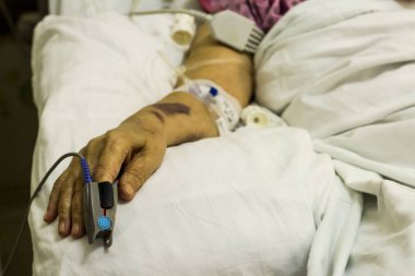 Hastane odasındaki yaşlı kadının kolu yoğun bakım ünitesinde. Tıbbi kategorinin kavramsal görüntüsü..