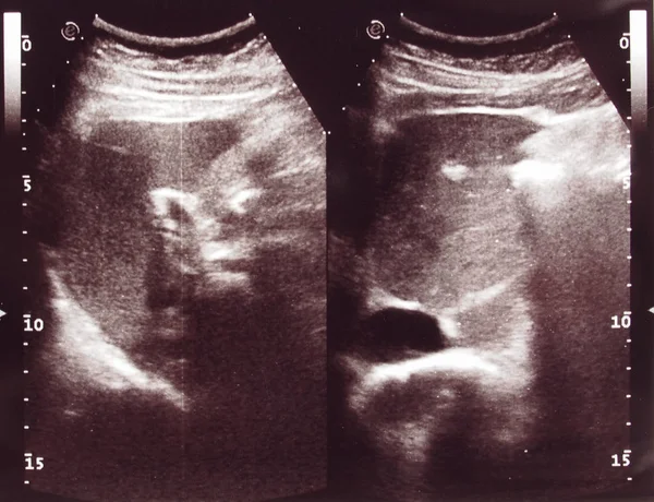 Diagnostyki Usg Aka Ultrasonografia Usg Podstawie Diagnostyczne Techniki Obrazowania Wykorzystywane — Zdjęcie stockowe
