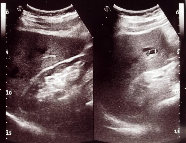 Diagnostic Sonography Aka Ultrasonography Ultrasound Based Diagnostic Imaging Technique Used — Stock Photo, Image