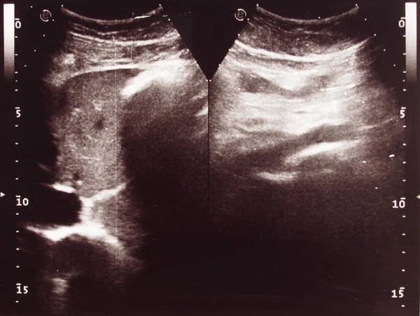 Diagnostic Sonography Aka Ultrasonography Ultrasound Based Diagnostic Imaging Technique Used — Stock Photo, Image