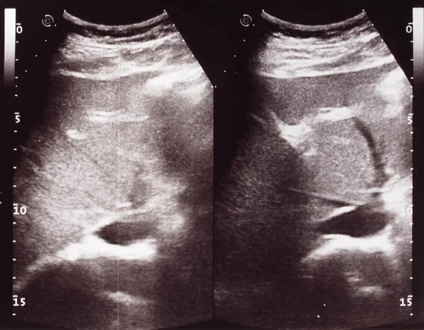 Diagnostic Sonography Aka Ultrasonography Ultrasound Based Diagnostic Imaging Technique Used — Stock Photo, Image