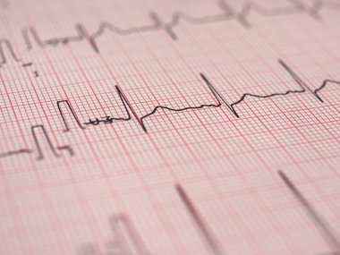 Elektrokardiyografi EKG aka Ekg kalp atışı - seçici odak ölçmek için Elektrokardiogramm