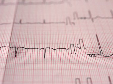 Elektrokardiyografi EKG aka Ekg kalp atışı - seçici odak ölçmek için Elektrokardiogramm