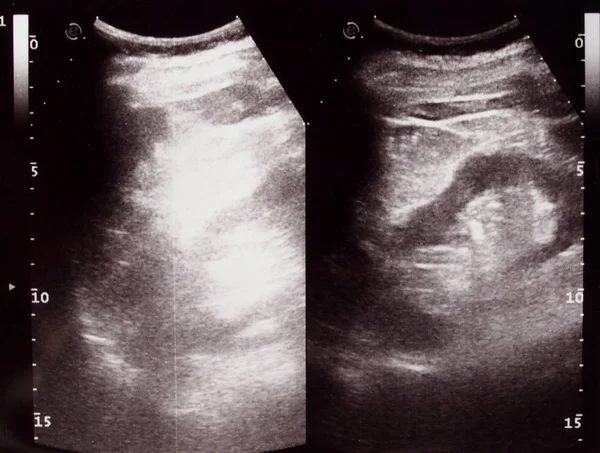 Diagnostic Sonography Aka Ultrasonography Ultrasound Based Diagnostic Imaging Technique Used — Stock Photo, Image