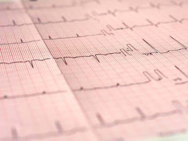 Elektrokardiyografi EKG aka Ekg kalp atışı - seçici odak ölçmek için Elektrokardiogramm