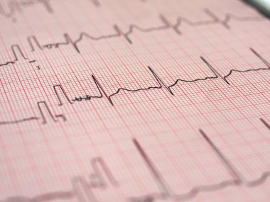 Elektrokardiyografi EKG aka Ekg kalp atışı - seçici odak ölçmek için Elektrokardiogramm