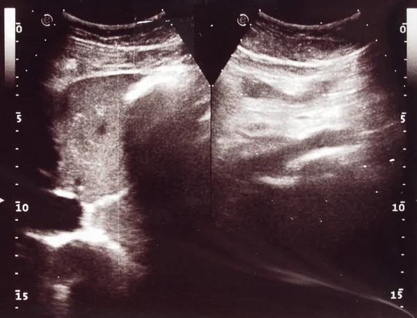 Diagnostische Echografie Aka Ultrasonografie Echografie Gebaseerd Diagnostische Imaging Techniek Die — Stockfoto