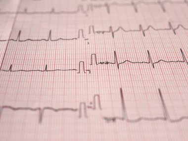 Elektrokardiyografi EKG aka Ekg kalp atışı - seçici odak ölçmek için Elektrokardiogramm