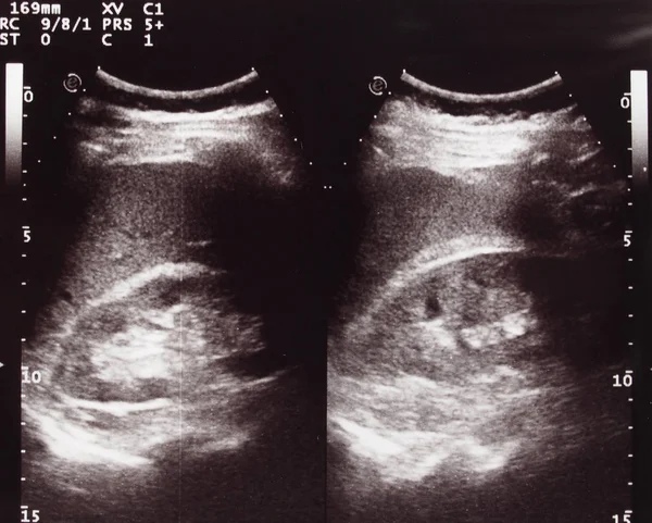 Ultrassonografia Diagnóstica Também Conhecida Como Ultrassonografia Técnica Diagnóstico Por Imagem — Fotografia de Stock