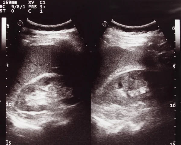 Diagnostic Sonography Aka Ultrasonography Ultrasound Based Diagnostic Imaging Technique Used Stock Photo