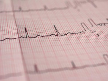 Elektrokardiyografi EKG aka Ekg kalp atışı - seçici odak ölçmek için Elektrokardiogramm