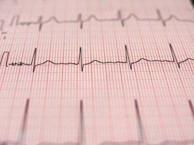 Elektrokardiyografi EKG aka Ekg kalp atışı - seçici odak ölçmek için Elektrokardiogramm
