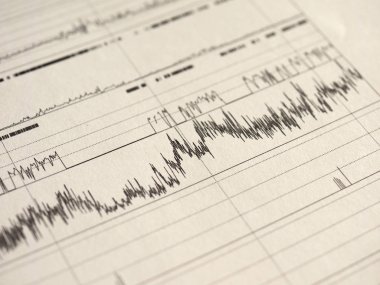 Polisomnografi (Psg) uyku çalışması çok parametrik test tanı aracı