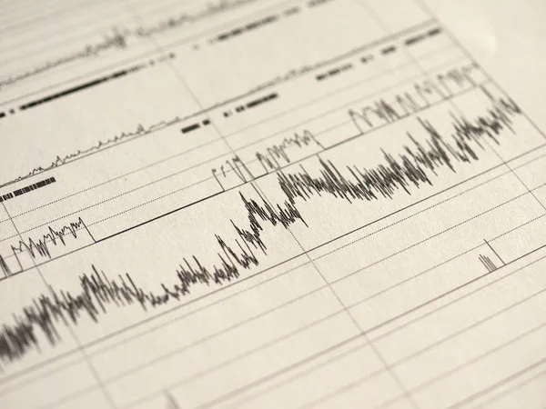 Polysomnography Psg Sleep Study Multi Parametric Test Diagnostic Tool Royalty Free Stock Photos