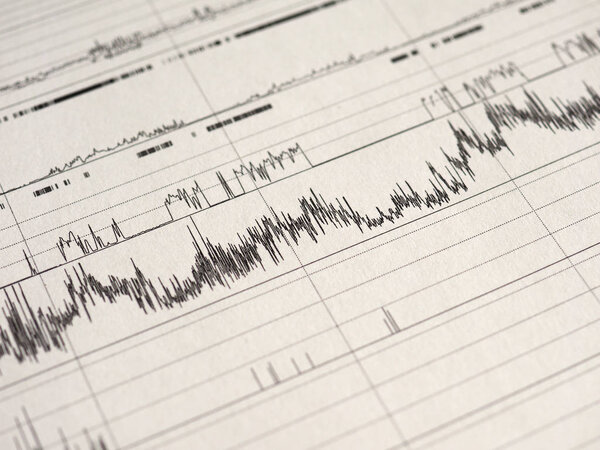 полисомнография (PSG) исследование сна многопараметрический тест диагностический инструмент
