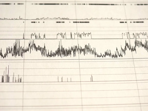 polysomnography (PSG) sleep study multi parametric test diagnostic tool