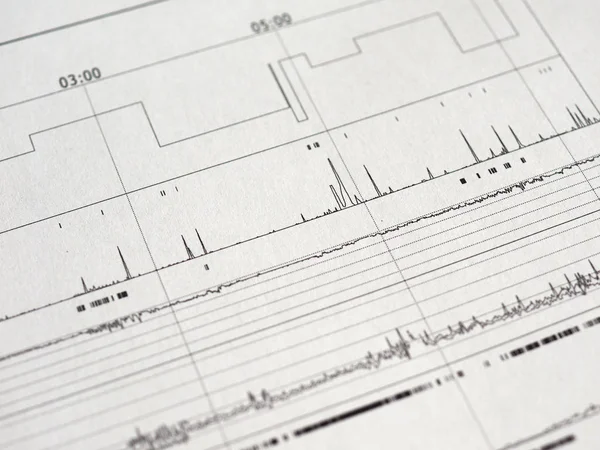Polisomnografi (Psg) uyku çalışması çok parametrik test tanı aracı