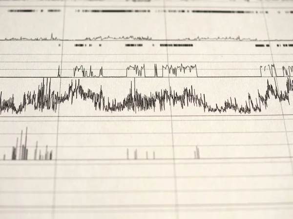 Polisomnografi (Psg) uyku çalışması çok parametrik test tanı aracı
