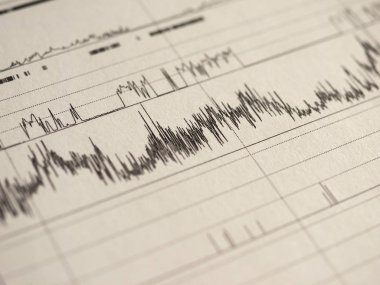 Polisomnografi (Psg) uyku çalışması çok parametrik test tanı aracı