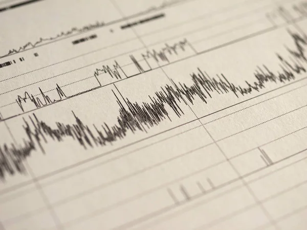 Polysomnografi Psg Sömn Studie Multi Parametrisk Test Diagnostiska Verktyg Stockfoto