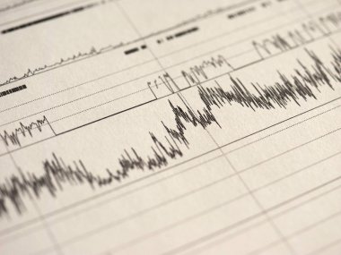 Polisomnografi (Psg) uyku çalışması çok parametrik test tanı aracı