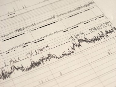 Polisomnografi (Psg) uyku çalışması çok parametrik test tanı aracı