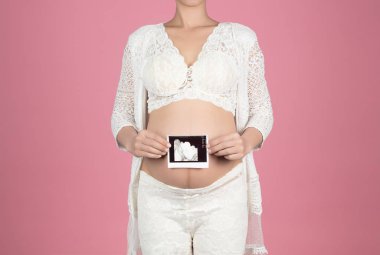 Pregnant woman holding ultrasound scan on her belly isolated on 