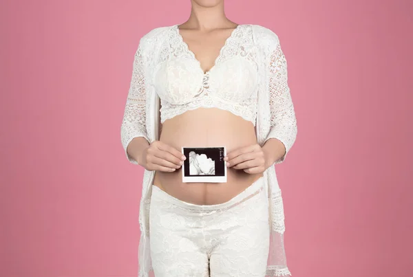 Mujer embarazada sosteniendo ultrasonido exploración en su vientre aislado en —  Fotos de Stock