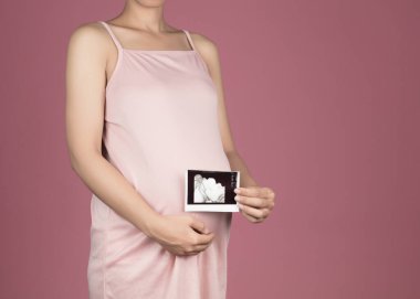 Pregnant woman holding ultrasound scan on her belly isolated on 