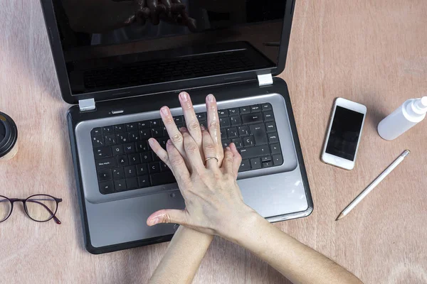 Covid Desinfecção Mãos Com Hidrogel Mesa Trabalho Com Computador Portátil — Fotografia de Stock