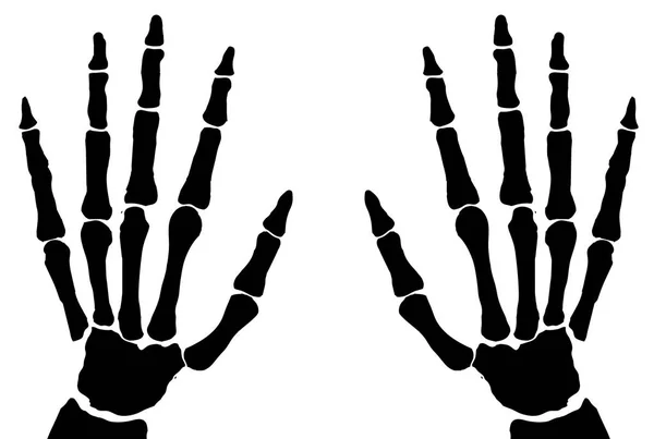 Τα χέρια των οστών απομονωμένες — Διανυσματικό Αρχείο