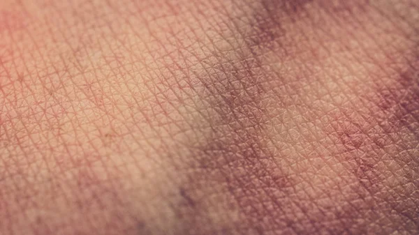 Macro close up of human skin cells, veins — Stock Photo, Image