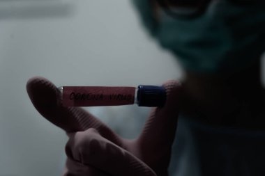 Koronavirüs karantinası kavramı. Mers-Cov. Roman Coronavirus (2019-ncov). Pozitif Coronavirus testi kan örneği. 2019 ncov salgını