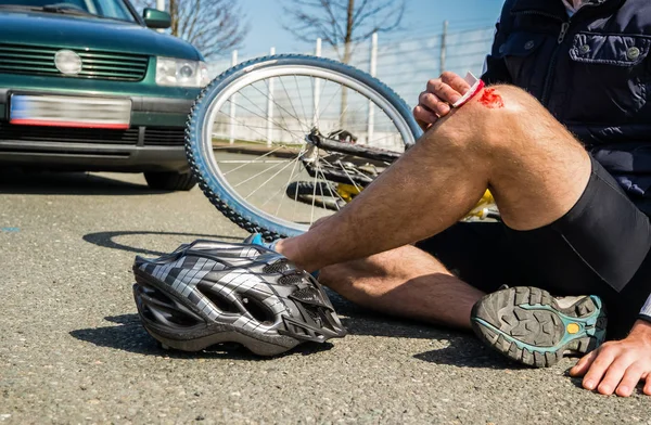 Bicycle accident injury knee
