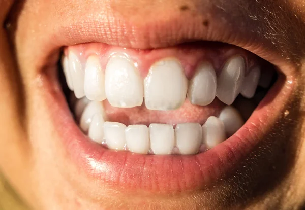 Bellissimo sfondo denti bianchi — Foto Stock