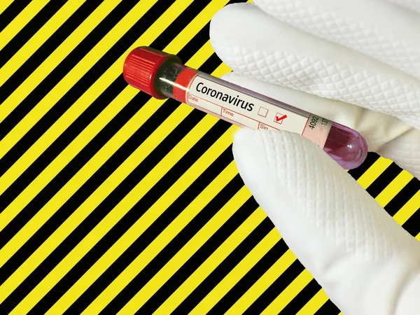 Warning Sign Coronavirus Alarm Symbol Blood Tube