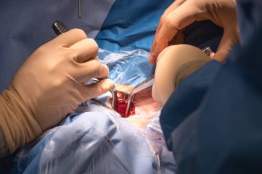 Ameliyathanede Cerrahi operasyon 