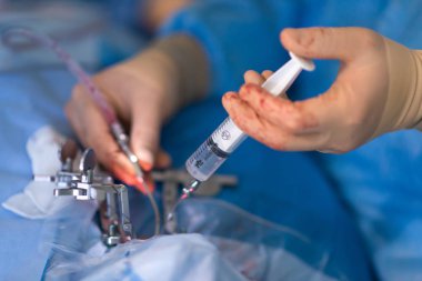  Ameliyathanede Cerrahi operasyon