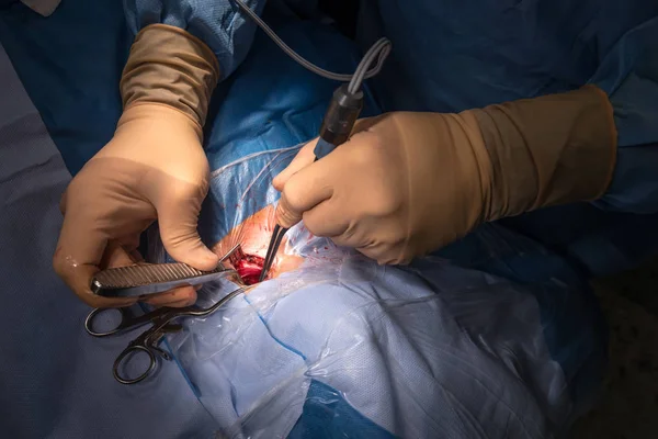 Surgical operation in the operating room — Stock Photo, Image