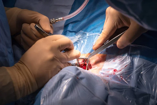 Surgical operation in the operating room — Stock Photo, Image