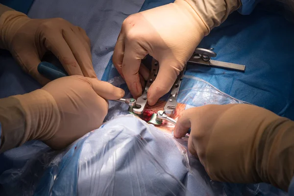 Operação cirúrgica na sala de cirurgia — Fotografia de Stock