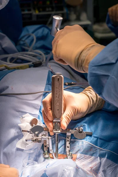 Хирургическая операция в операционной — стоковое фото