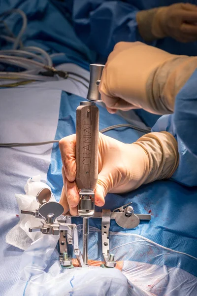 Detalhe Uma Operação Cirúrgica Sala Cirurgia Hospital — Fotografia de Stock